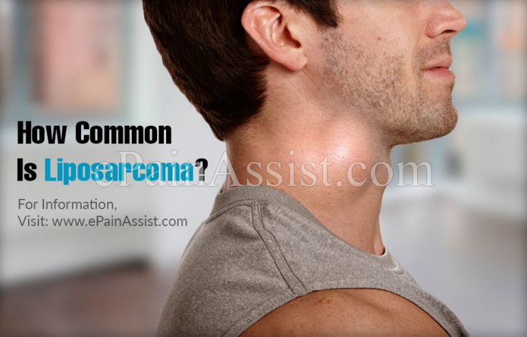 How Common Is Liposarcoma?