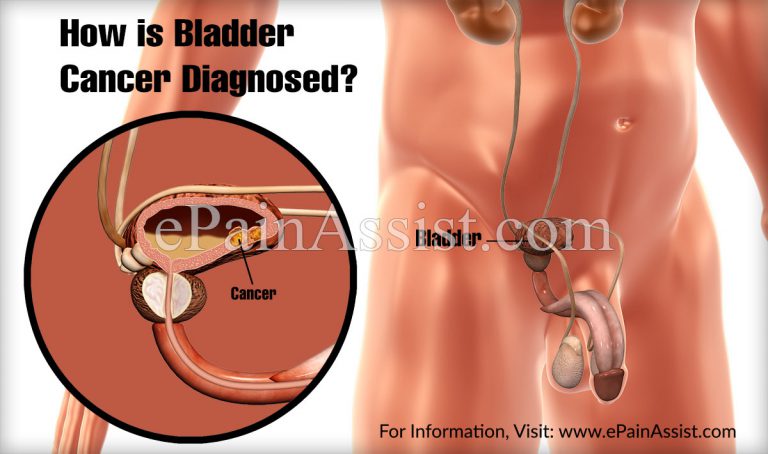 How is Bladder Cancer Diagnosed?