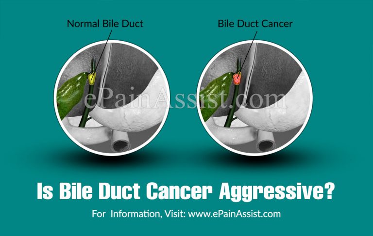 Is Bile Duct Cancer Aggressive? | How Long Do You Live with Bile Duct Cancer?