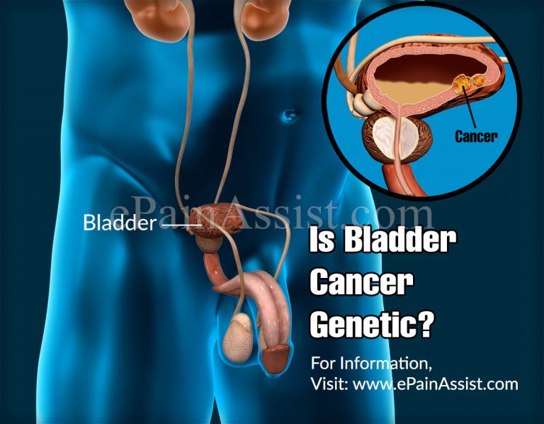 Is Bladder Cancer Genetic?
