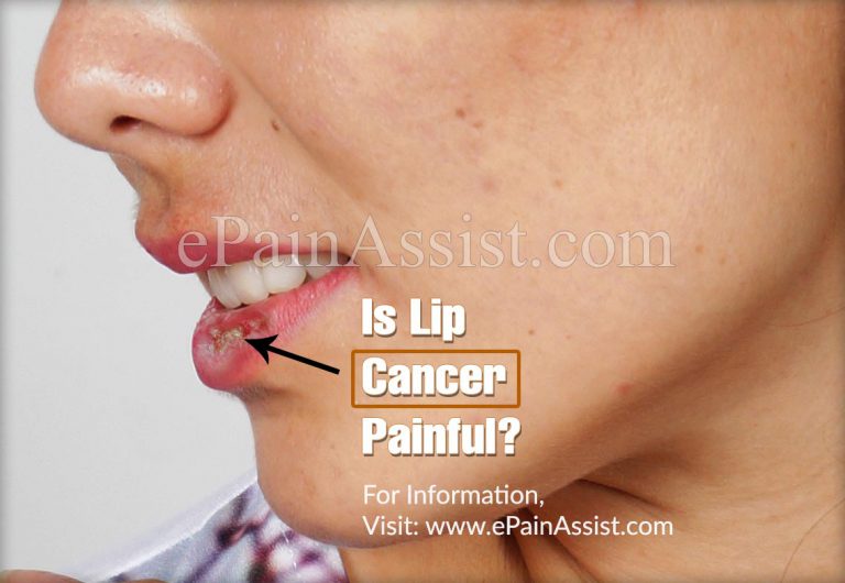 Is Lip Cancer Painful?