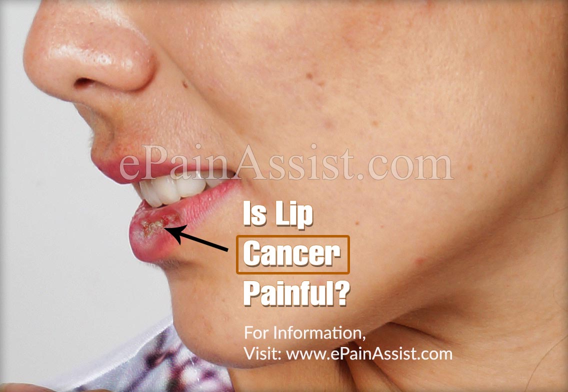 Is Lip Cancer Painful?