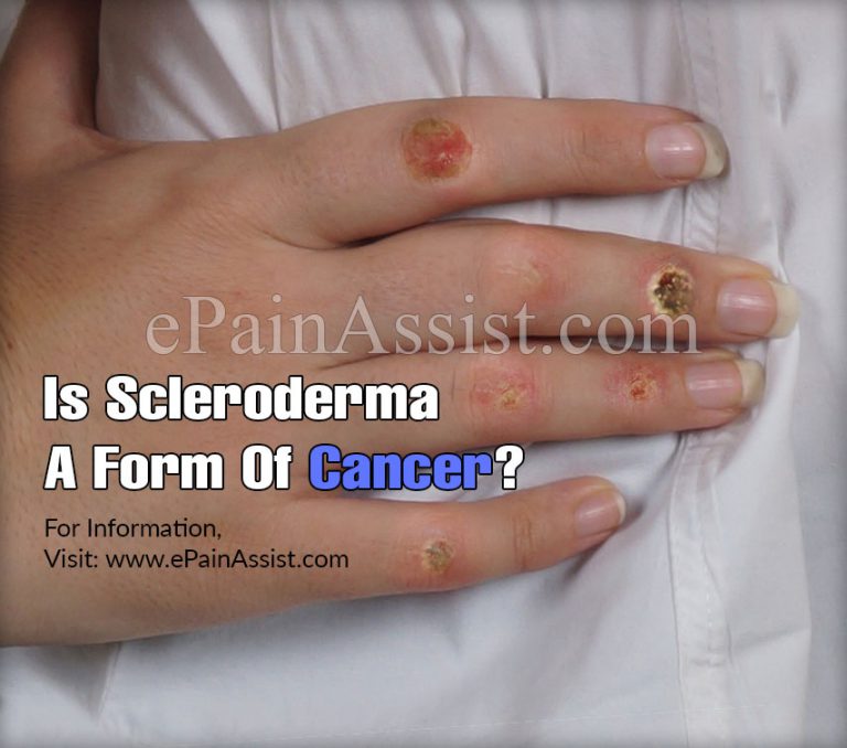 Is Scleroderma A Form Of Cancer?