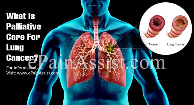 What is Palliative Care For Lung Cancer & Different Palliative Approach for Treatment Lung Cancer Symptoms