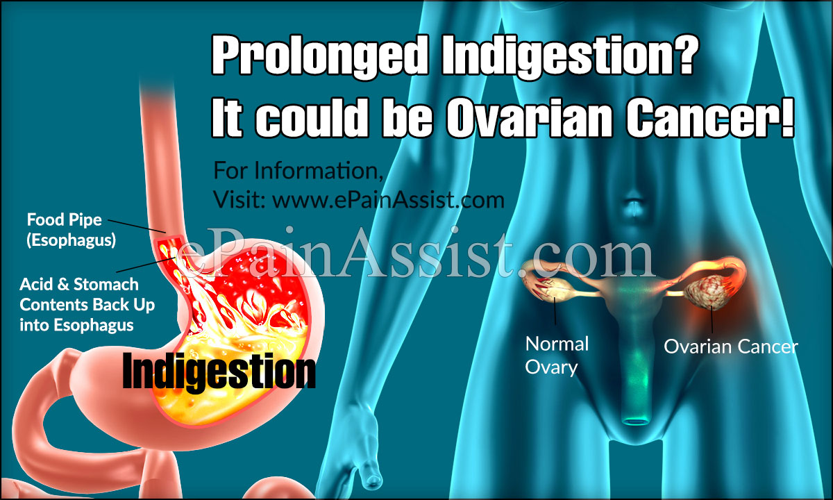 Prolonged Indigestion? It could be Ovarian Cancer!