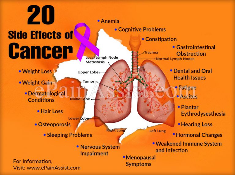20 Side Effects of Cancer