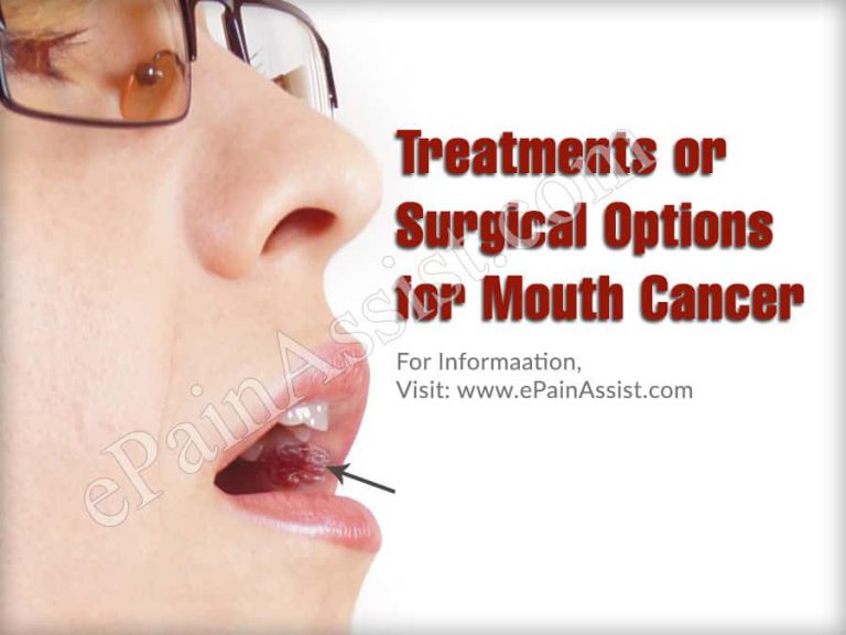 6 Treatments or Surgical Options for Mouth Cancer