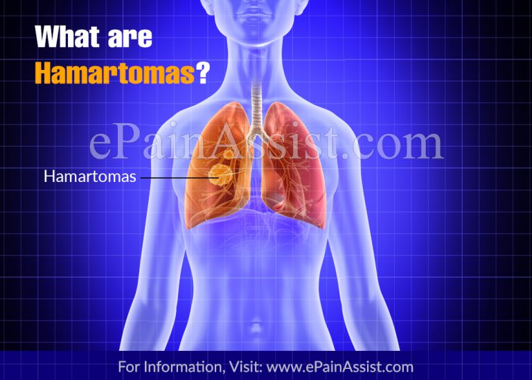 Hamartomas: Causes, Symptoms, Treatment, Types, Locations, Can it Spread?
