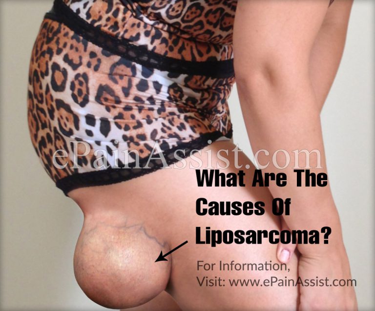 What Are The Causes Of Liposarcoma?