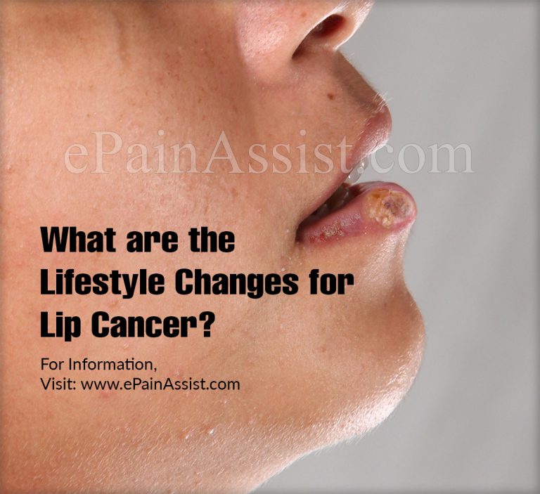 What Are The Lifestyle Changes For Lip Cancer?