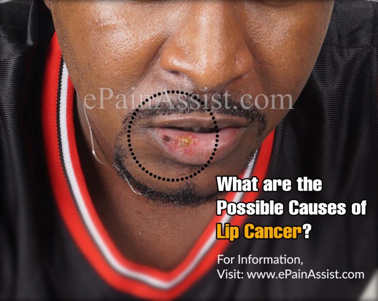 What Are The Possible Causes of Lip Cancer?