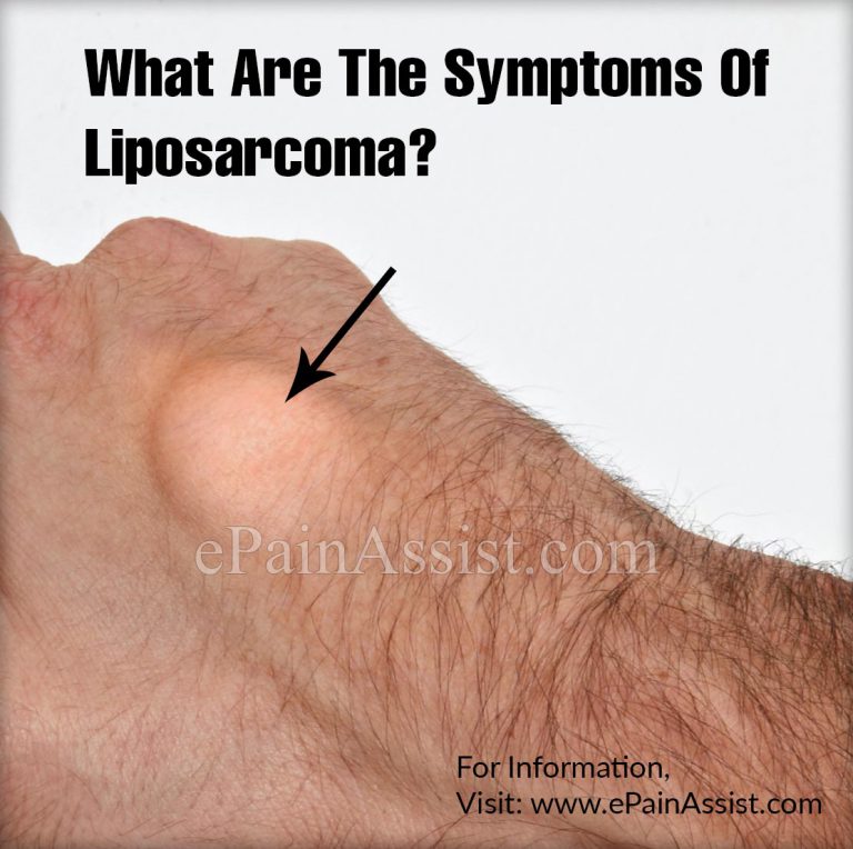 What Are The Symptoms Of Liposarcoma?