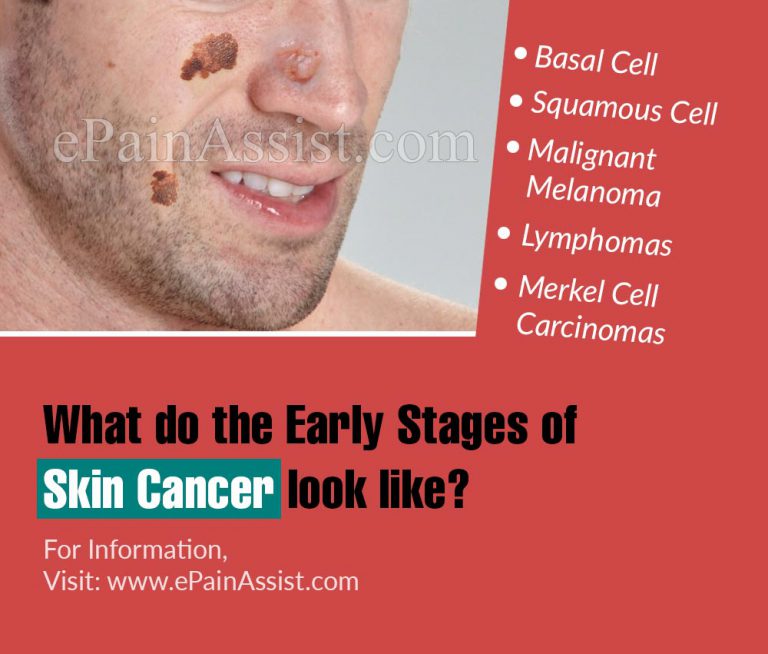 What Do The Early Stages Of Skin Cancer Look Like?
