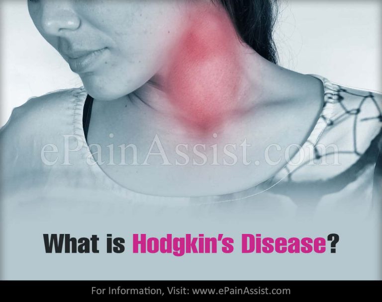 What is Hodgkin’s Disease & What is its Treatment, Prognosis?|Types, Causes, Symptoms, Staging of Hodgkin’s Disease