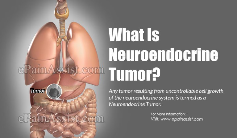 What is Neuroendocrine Tumor & How is it Treated?|Causes, Symptoms, Prognosis of Neuroendocrine Tumor