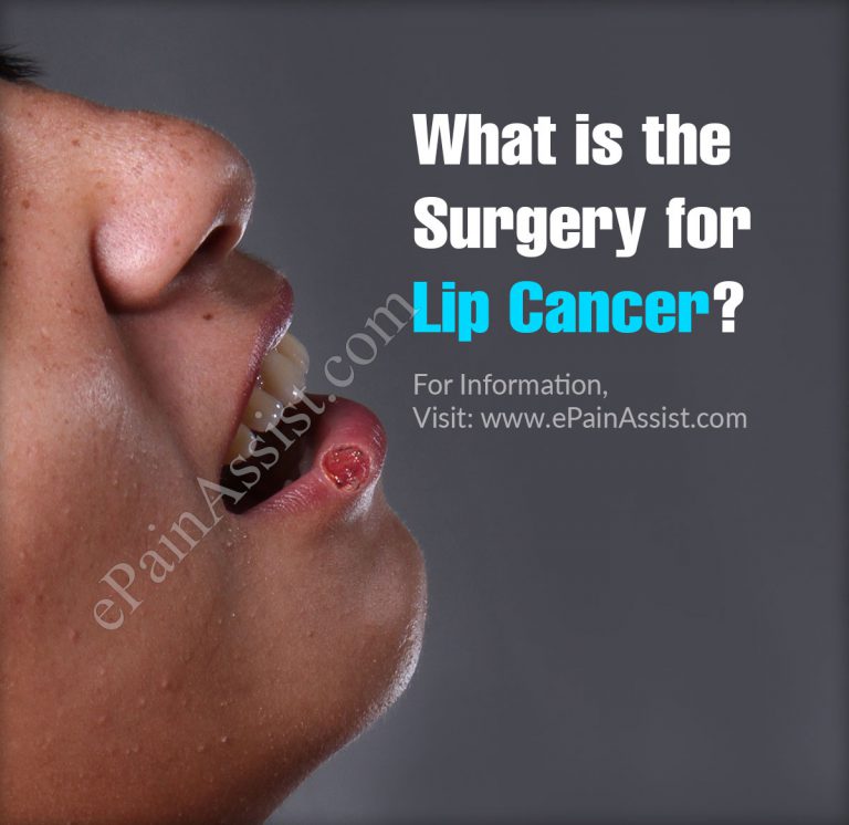 What Is The Surgery For Lip Cancer?