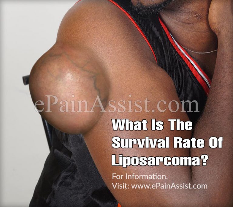 What Is The Survival Rate Of Leiomyosarcoma?