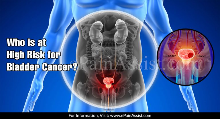 Who is at High Risk for Bladder Cancer?
