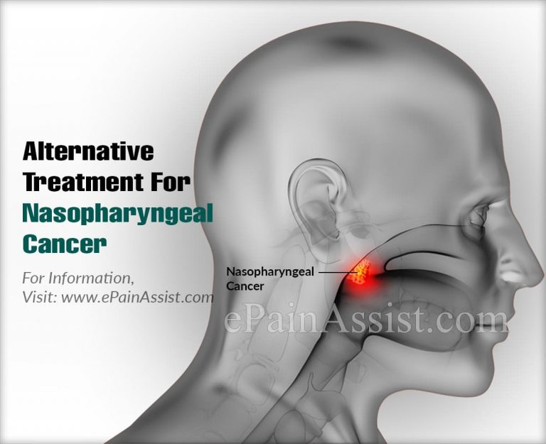 Alternative Treatment For Nasopharyngeal Cancer & Is It A Progressive Disease?