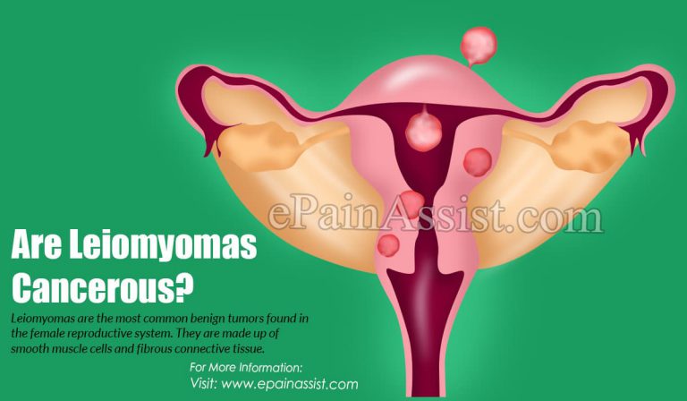 Are Leiomyomas Cancerous?