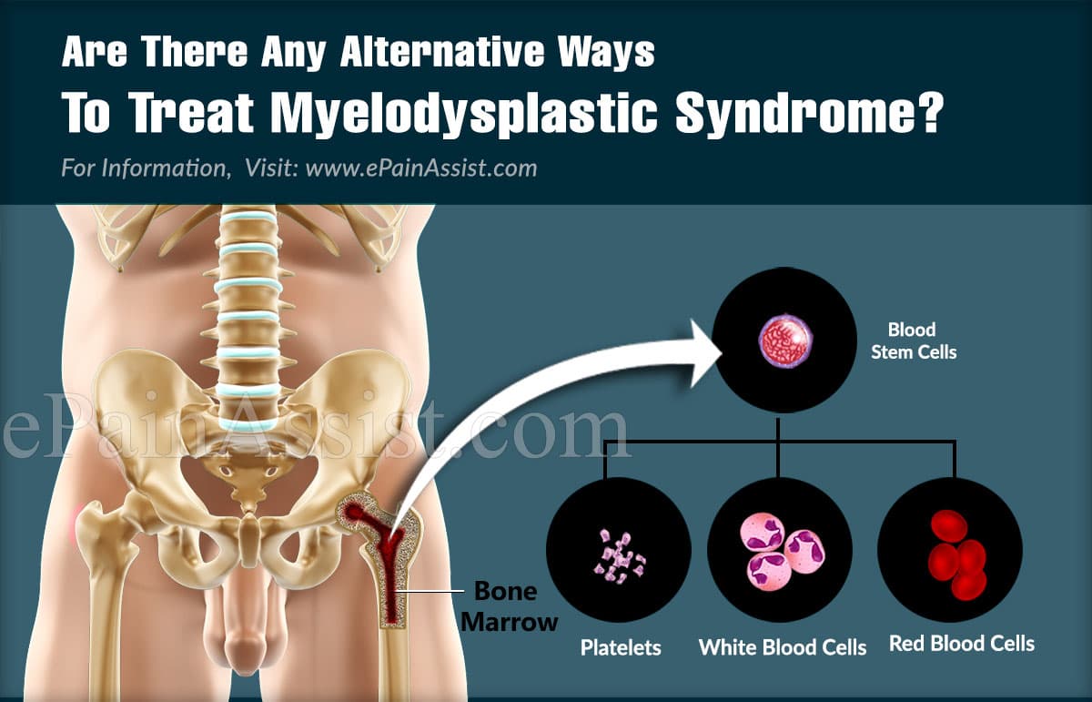 Are There Any Alternative Ways To Treat Myelodysplastic Syndrome?