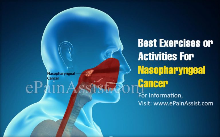 Best Exercises/Activities For Nasopharyngeal Cancer