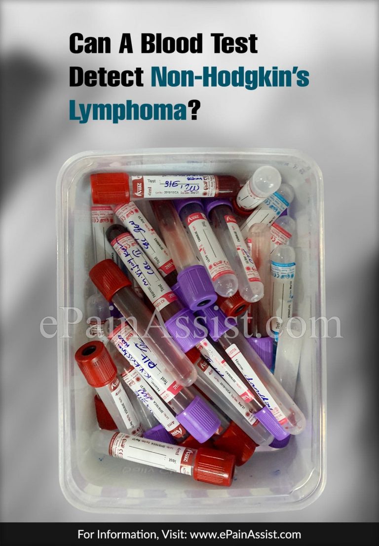 Can A Blood Test Detect Non-Hodgkin’s Lymphoma?