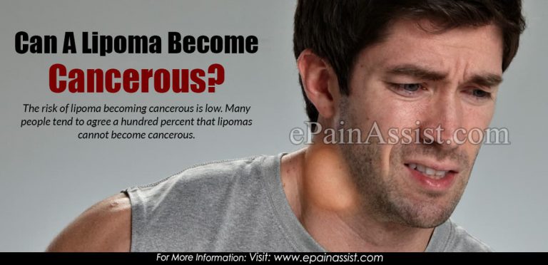 Can A Lipoma Become Cancerous?