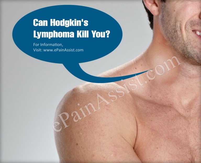 Can Hodgkin’s Lymphoma Kill You?