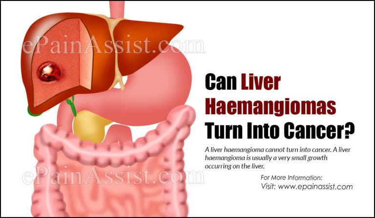 Can Liver Haemangiomas Turn Into Cancer?