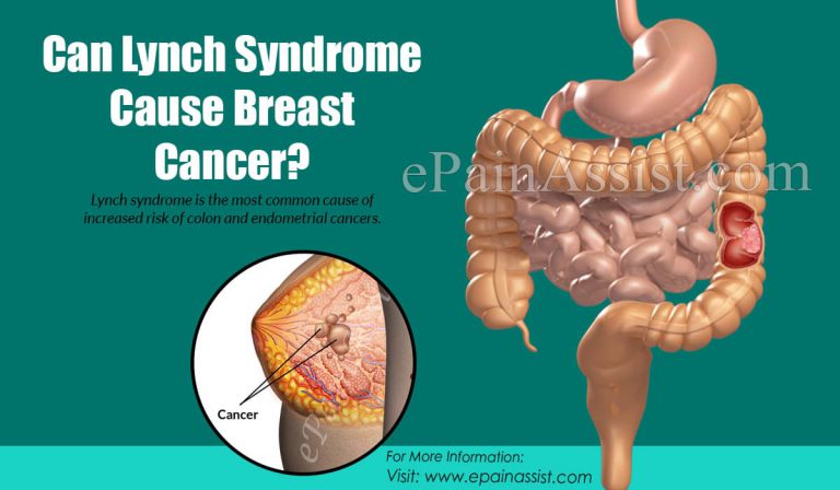 Can Lynch Syndrome Cause Breast Cancer?