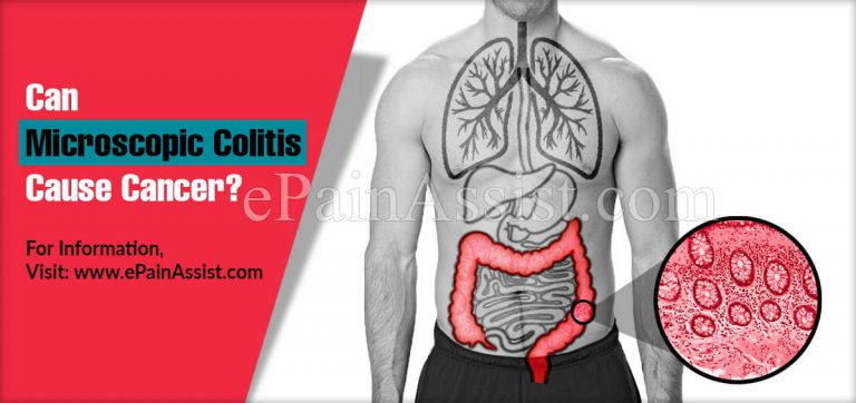 Can Microscopic Colitis Cause Cancer?