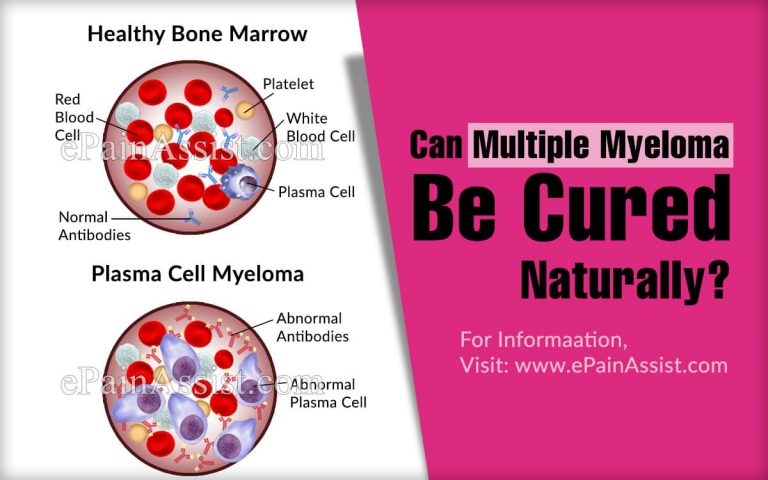 Can Multiple Myeloma Be Cured Naturally?