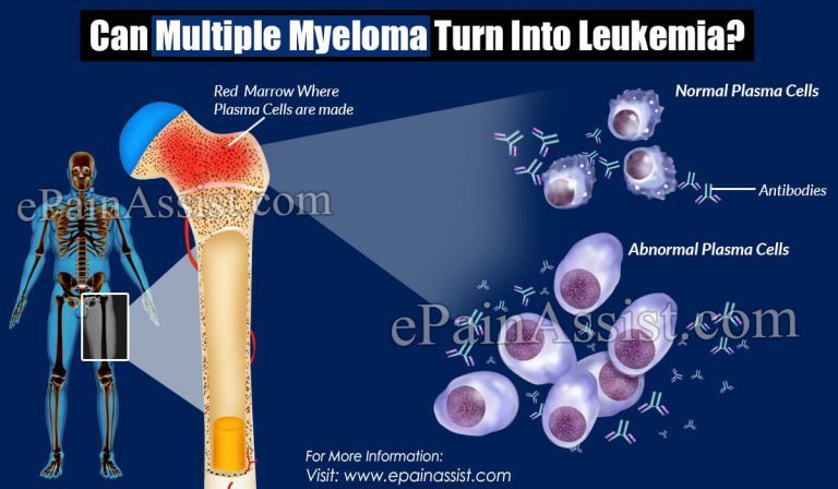 Can Multiple Myeloma Turn Into Leukemia?