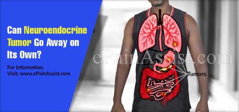 Can Neuroendocrine Tumor Go Away on Its Own & What Are It’s Natural Remedies?