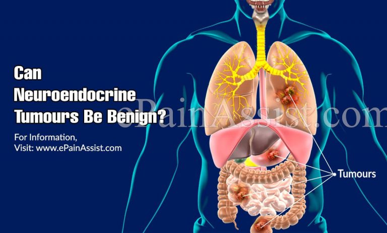 Can Neuroendocrine Tumours Be Benign & Do They Cause Pain?