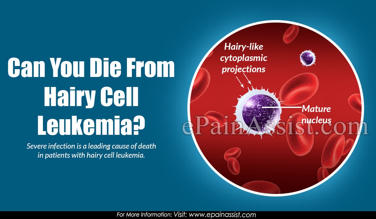 Can You Die From Hairy Cell Leukemia?