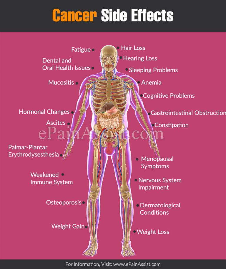 Cancer Side Effects