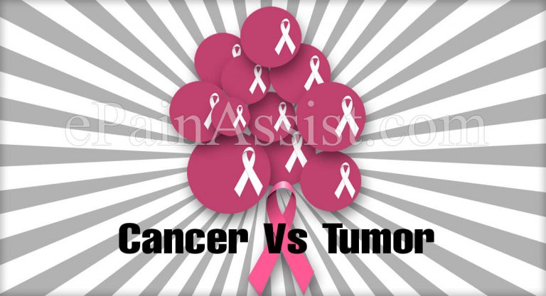 Cancer Vs Tumor: Differences Worth Knowing