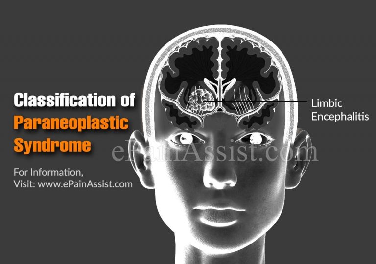Classification Of Paraneoplastic Syndrome