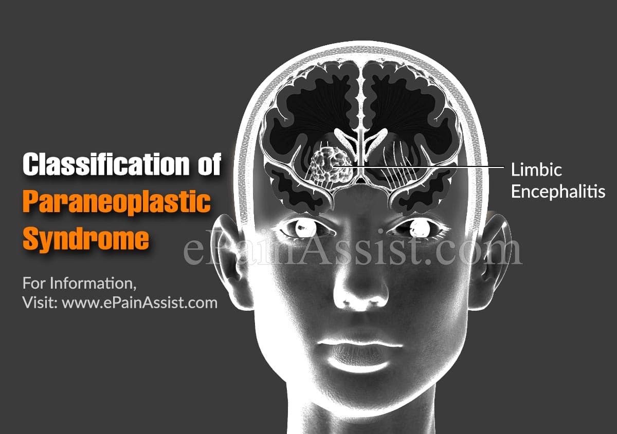 Classification Of Paraneoplastic Syndrome