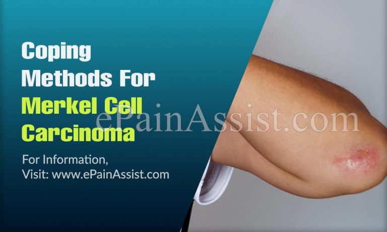 Coping Methods For Merkel Cell Carcinoma