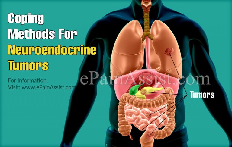 Coping Methods For Neuroendocrine Tumors