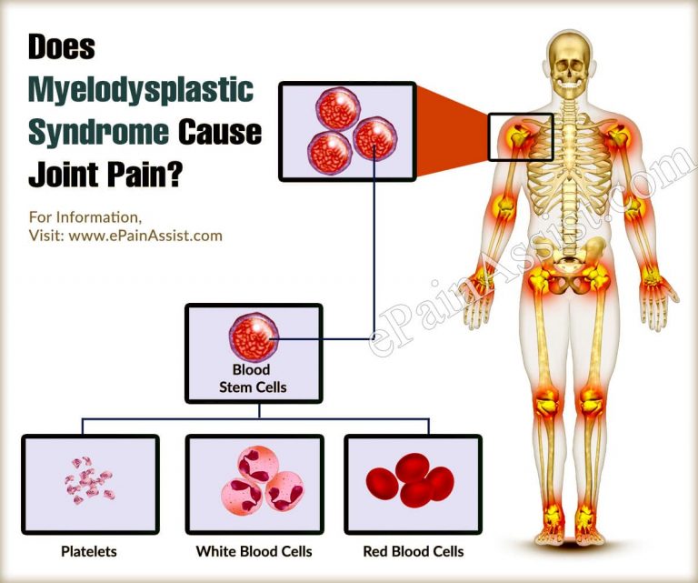 Does Myelodysplastic Syndrome Cause Joint Pain & Shortness Of Breath?