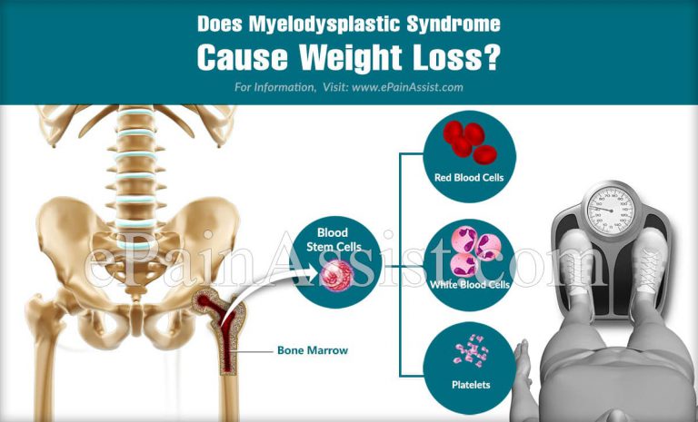 Does Myelodysplastic Syndrome Cause Weight Loss?