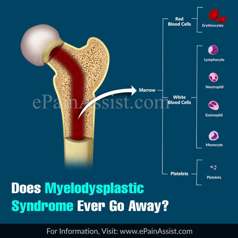 Does Myelodysplastic Syndrome Ever Go Away?