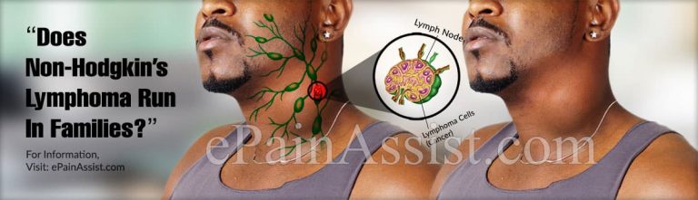 Does Non-Hodgkin’s Lymphoma Run In Families?