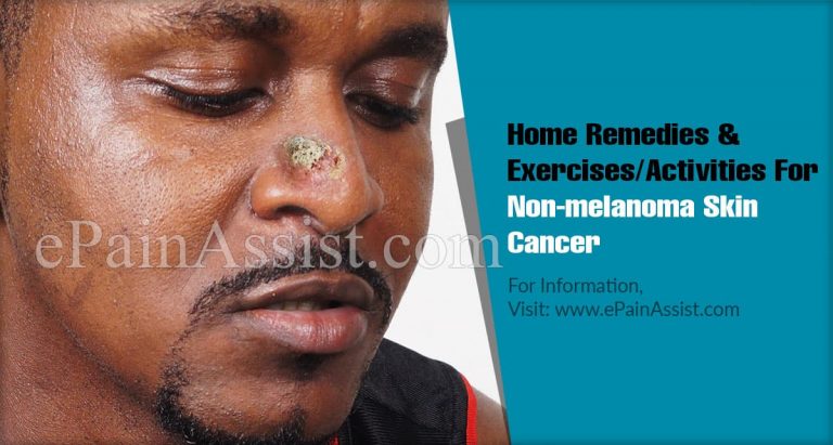 Home Remedies & Exercises/Activities For Non-melanoma Skin Cancer
