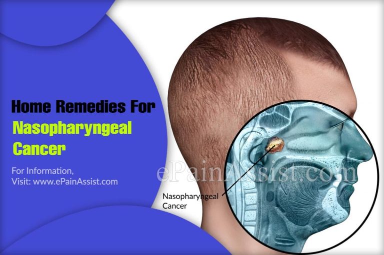 Home Remedies For Nasopharyngeal Cancer
