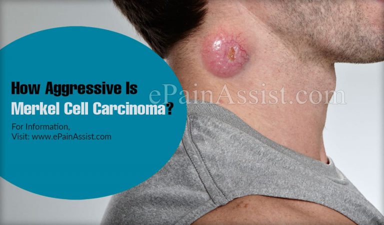 How Aggressive Is Merkel Cell Carcinoma & What Is The Function Of A Merkel Cell?